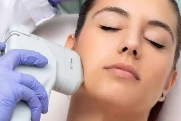 Image of woman having HIFU Essex treatment