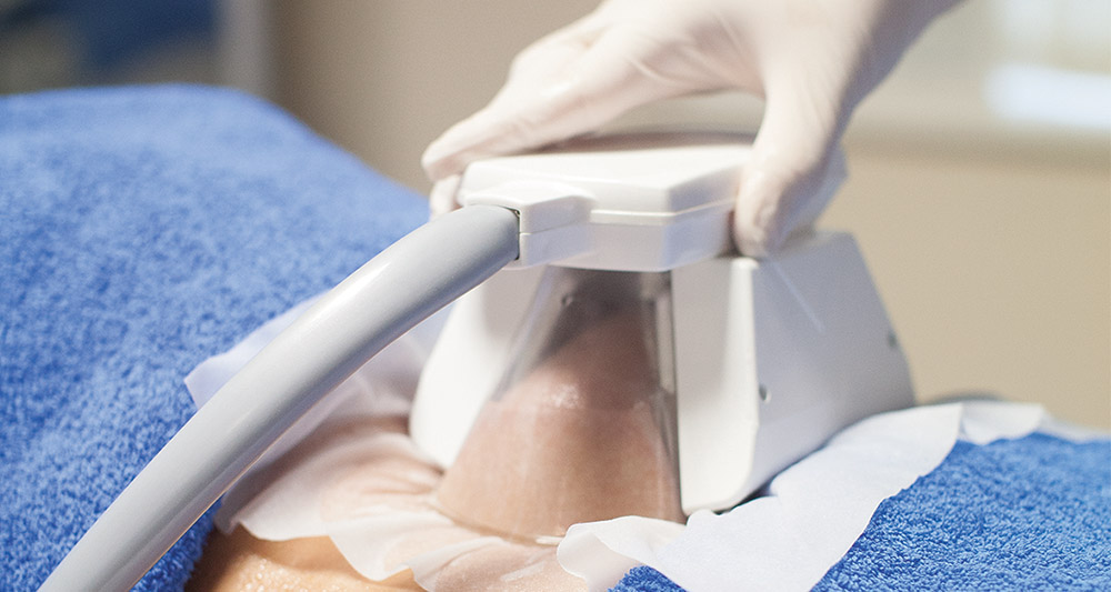 How Fat Freezing and HIFU Work Together? 2 Multiple Areas in One Session HIFU and Fat Freezing Essex