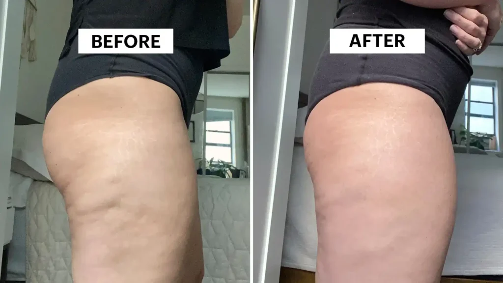 Do Toning Exercise Essex Really Tackle Cellulite?