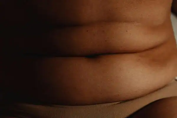 The Hidden Connection: How Stress Shapes Your Fitness and Body Composition 3 image of what stress can do on the stomach area and how Lipo 360 Essex can help to change your body shape.