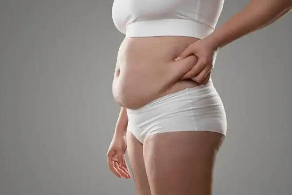 Image of stress belly Essex How Lipo 360 can help manage your symptoms